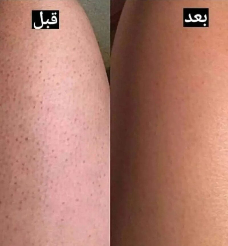 نمک بدن هلو